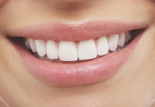 Close up of a smile with flawless teeth after cosmetic dentistry in Inver Grove Heights