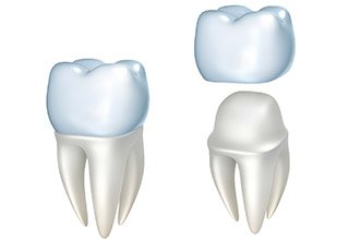 Illustration of a dental crown in Inver Grove Heights covering a tooth