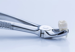 Metal clasp holding an extracted tooth