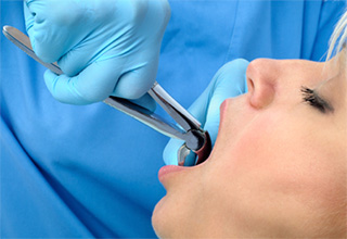Closeup of patient having tooth removed