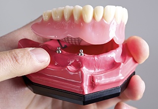 Hand holding a model of an implant denture in Inver Grove Heights