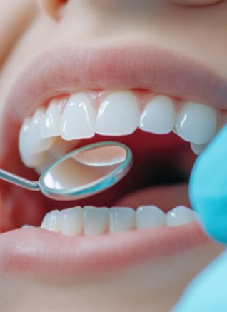 A checkup and cleaning will help keep your teeth healthy near Mendota Heights