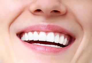 Close up of a smile with straight white teeth