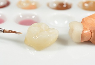 Two dental crowns being crafted