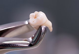 Metal clasp holding an extracted tooth